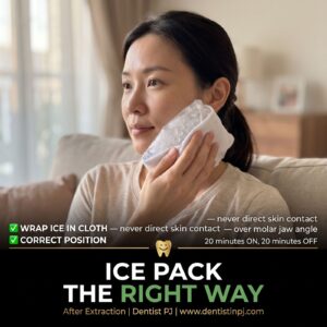 Correct way to apply an ice pack to the cheek after tooth extraction