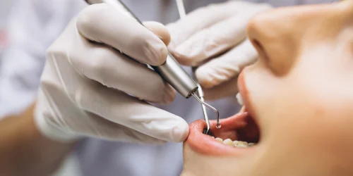 Dental Checkup