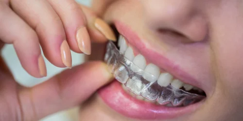 teeth braces in PJ